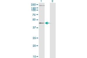 Western Blot analysis of STEAP1 expression in transfected 293T cell line by STEAP1 monoclonal antibody (M01), clone 4F6-1F3. (STEAP1 antibody  (AA 1-339))