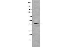 Western blot analysis of CCRL2 using A549 whole cell lysates (CCRL2 antibody  (Internal Region))