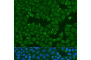 Immunofluorescence analysis of U2OS cells using KRT6B Polyclonal Antibody at dilution of 1:100. (Keratin 6B antibody)