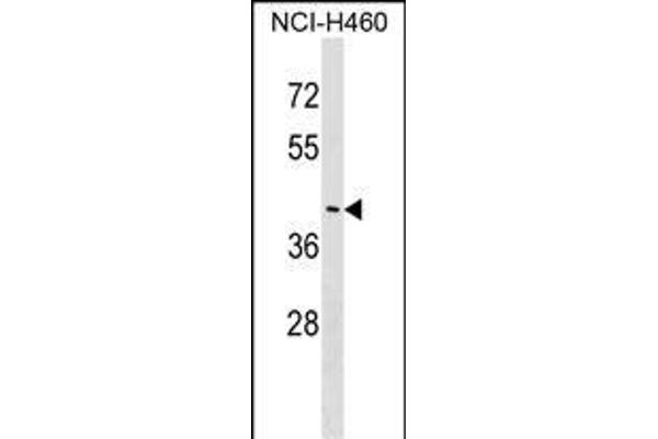 FEZ2 antibody  (N-Term)