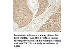 Image no. 1 for anti-Vascular Endothelial Growth Factor A (VEGFA) antibody (ABIN791193) (VEGFA antibody)
