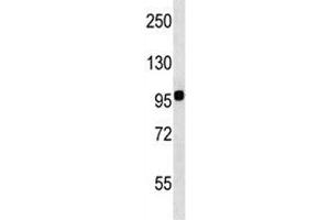 Integrin beta 7 antibody western blot analysis in WiDr lysate. (Integrin beta 7 antibody  (AA 737-765))