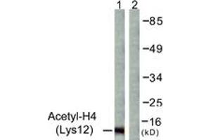 Western Blotting (WB) image for anti-Histone H4 (acLys12) antibody (ABIN2890734) (Histone H4 antibody  (acLys12))