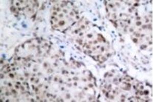 Image no. 2 for anti-Tumor Protein P53 (TP53) (pSer315) antibody (ABIN318092) (p53 antibody  (pSer315))