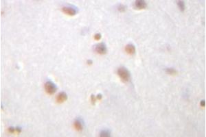 Image no. 2 for anti-Catenin (Cadherin-Associated Protein), delta 1 (CTNND1) antibody (ABIN317789) (CTNND1 antibody)