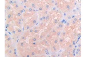 IHC-P analysis of Human Kidney Tissue, with DAB staining. (IL3RA antibody  (AA 19-157))