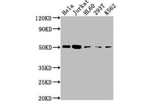 Western Blot Positive WB detected in: Hela whole cell lysate, Jurkat whole cell lysate, HL60 whole cell lysate, 293T whole cell lysate, K562 whole cell lysate All lanes: CASP2 antibody at 1:2000 Secondary Goat polyclonal to rabbit IgG at 1/50000 dilution Predicted band size: 51, 35, 11 kDa Observed band size: 51 kDa (Recombinant Caspase 2 antibody)