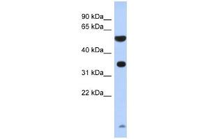 ESSPL antibody used at 1 ug/ml to detect target protein. (ESSPL antibody  (N-Term))