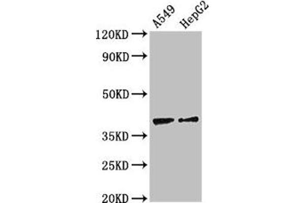 CCR1 antibody  (AA 314-362)