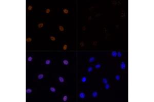 Immunofluorescence analysis of C6 cells using Acetyl-Histone H3-K23 (ABIN7267669) at dilution of 1:100. (Histone 3 antibody  (H3K23))