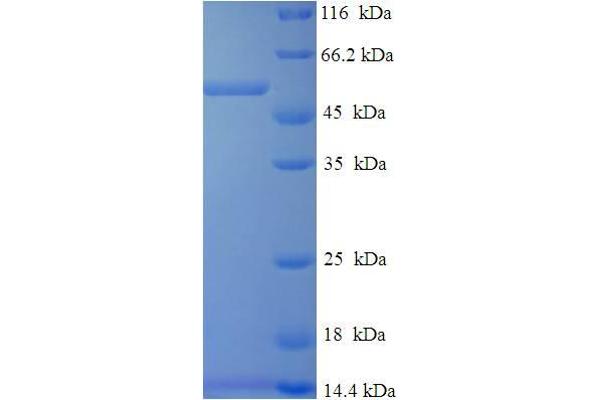 DHRS7 Protein (AA 29-339) (His-SUMO Tag)