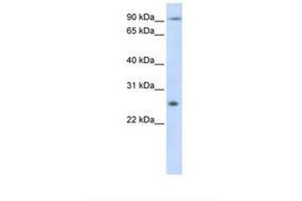 TSPAN31 antibody  (C-Term)