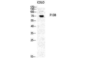 Western Blotting (WB) image for anti-Coagulation Factor 13, B Polypeptide (F13B) (N-Term) antibody (ABIN3184573) (F13B antibody  (N-Term))