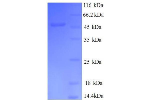 DRAP1 Protein (AA 4-198, partial) (GST tag)