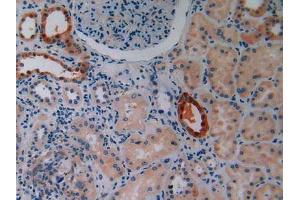 IHC-P analysis of Human Kidney Tissue, with DAB staining. (IGF2R antibody  (AA 2167-2442))