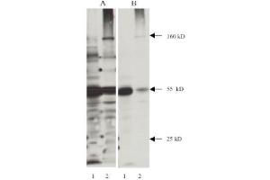 Western Blotting (WB) image for anti-Nitrotyrosine antibody (ABIN264465) (Nitrotyrosine antibody)