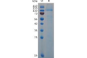 VWF Protein (AA 23-763) (His tag)