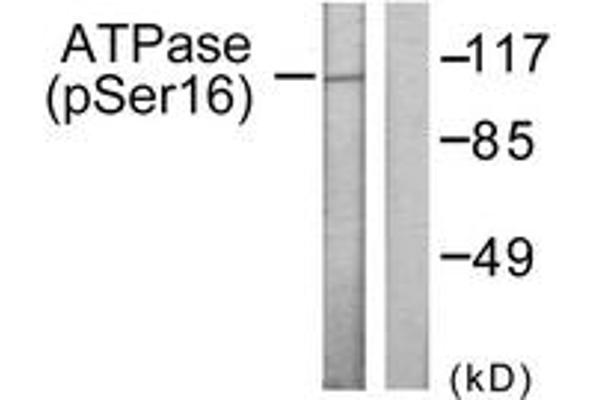 ATPase antibody  (pSer16)