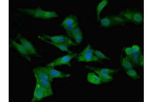 Immunofluorescent analysis of Hela cells using ABIN7145972 at dilution of 1:100 and Alexa Fluor 488-congugated AffiniPure Goat Anti-Rabbit IgG(H+L) (CCL2 antibody  (AA 24-99))