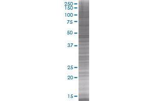 HDAC3 transfected lysate (HDAC3 293T Cell Transient Overexpression Lysate(Denatured))