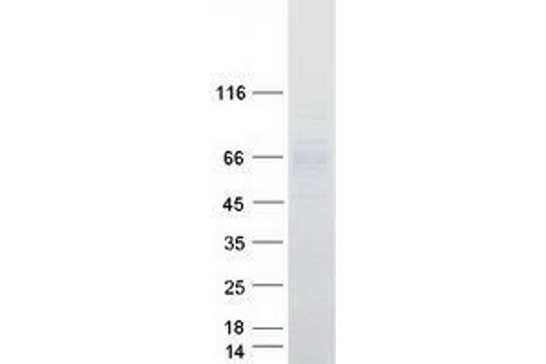 SLC39A5 Protein (Transcript Variant 1) (Myc-DYKDDDDK Tag)