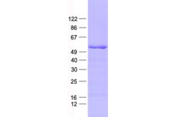 RBM22 Protein (His tag)