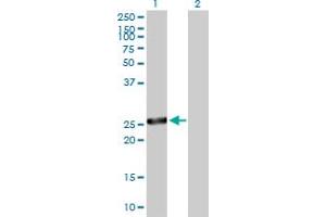 Western Blot analysis of IL6 expression in transfected 293T cell line by IL6 MaxPab polyclonal antibody. (IL-6 antibody  (AA 1-212))
