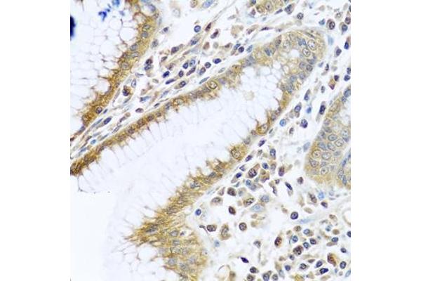 TMEM189 antibody  (C-Term)