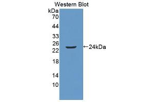 Western blot analysis of the recombinant protein. (Anoctamin 2 antibody  (AA 823-1003))