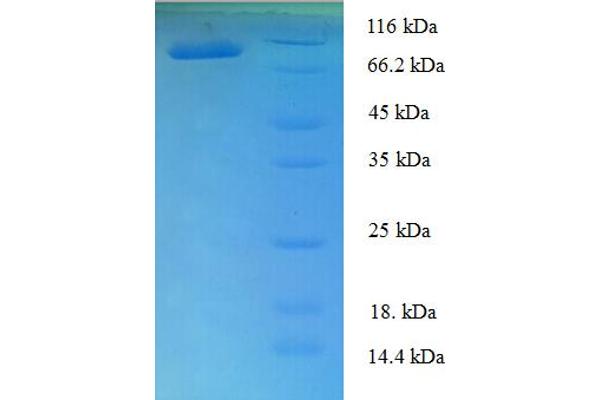 T-Box 18 Protein (TBX18) (AA 1-607, full length) (His-SUMO Tag)