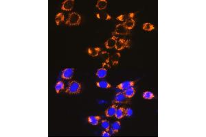 Immunofluorescence analysis of NIH-3T3 cells using IFN Rabbit pAb (ABIN7267947) at dilution of 1:100 (40x lens). (IFNAR1 antibody  (AA 470-557))