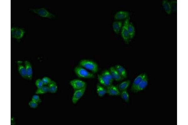 Ubiquilin 2 antibody  (AA 473-542)