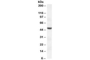 Western blot testing of HEK293 lysate with TMPRSS4 antibody at 1ug/ml. (TMPRSS4 antibody)
