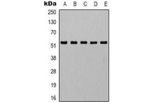 Western blot analysis of Alpha-tubulin expression in mouse skeletal muscle (A), mouse kidney (B), mouse heart (C), mouse brain (D), mouse liver (E) whole cell lysates. (alpha Tubulin antibody)