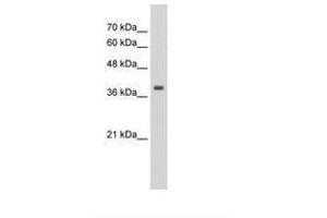 Image no. 2 for anti-Tropomyosin alpha-1 Chain (TM7) (AA 20-69) antibody (ABIN203350) (TM7 antibody  (AA 20-69))