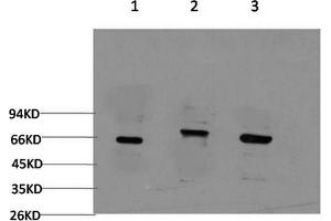 Western Blotting (WB) image for anti-Beclin 1, Autophagy Related (BECN1) antibody (ABIN5960439) (Beclin 1 antibody)