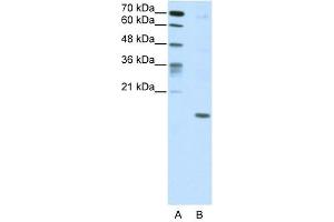 DUX5 antibody (20R-1209) used at 0. (DUX5 抗体  (C-Term))