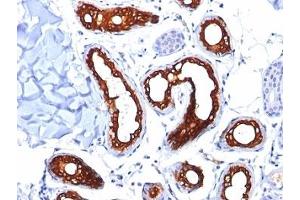 Formalin-fixed, paraffin-embedded human skin stained with Cytokeratin 18 antibody (KRT18/834). (Cytokeratin 18 antibody)