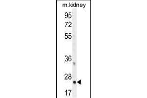 Western blot analysis in mouse kidney tissue lysates (35ug/lane). (HOXB6 antibody  (AA 128-155))