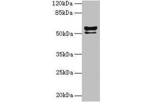 Western blot All lanes: KRT72 antibody at 2 μg/mL + MCF-7 whole cell lysate Secondary Goat polyclonal to rabbit IgG at 1/10000 dilution Predicted band size: 56, 52 kDa Observed band size: 56, 52 kDa (Keratin 72 antibody  (AA 301-511))