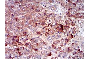 Immunohistochemistry (IHC) image for anti-Colony Stimulating Factor 1 Receptor (CSF1R) (AA 344-497) antibody (ABIN1724925)