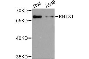 Western blot analysis of extracts of various cell lines, using KRT81 antibody (ABIN6292166) at 1:3000 dilution. (KRT81 antibody)