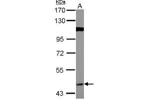 WB Image Sample (30 ug of whole cell lysate) A: A549 7. (BACE1 antibody)