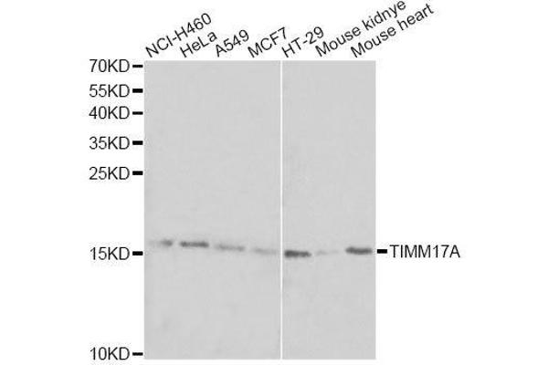 TIMM17A antibody  (AA 1-171)