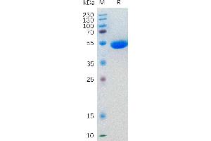 Human IL5 Protein, hFc Tag on SDS-PAGE under reducing condition. (IL-5 Protein (AA 20-134) (Fc Tag))