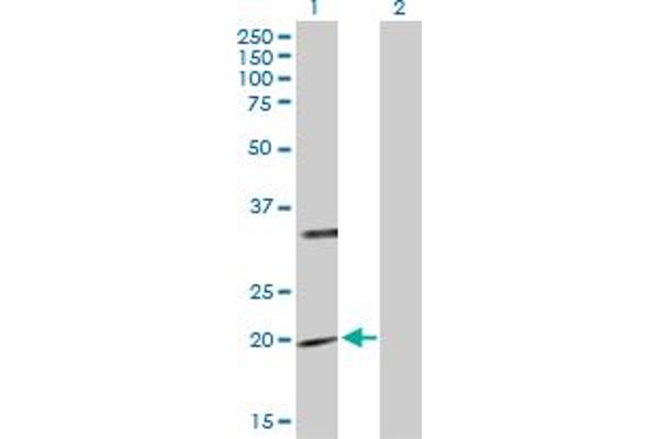 PTPMT1 antibody  (AA 1-201)