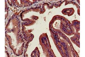 Immunohistochemistry of paraffin-embedded human prostate tissue using ABIN7149984 at dilution of 1:100 (DPP4 antibody  (AA 473-588))