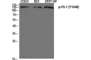 Western Blotting (WB) image for anti-Fms-Related tyrosine Kinase 1 (VEGFR1) (FLT1) (pTyr1048) antibody (ABIN5961614) (FLT1 antibody  (pTyr1048))
