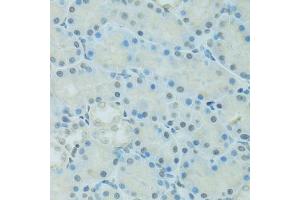 Immunohistochemistry of paraffin-embedded rat kidney using CEBPA antibody (ABIN6003503) at dilution of 1/100 (40x lens). (CEBPA antibody)