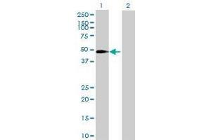 Lane 1: SLC37A3 transfected lysate ( 54. (SLC37A3 293T Cell Transient Overexpression Lysate(Denatured))